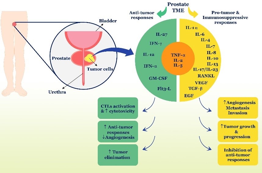Role of cytokines in prostate cancer.